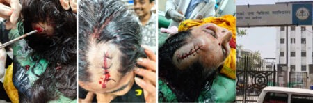 Brutal Attack by Thugs in Ayodhya: Intruders Rampage Against Women Inside Home; Three Injured