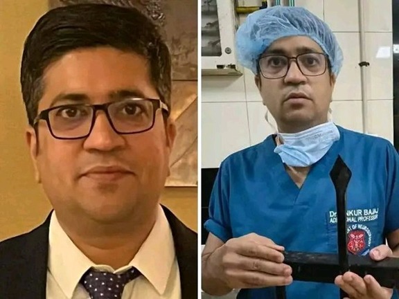 Iron rod pierces 3-year-old Kartik’s head; private hospital demanded ₹15 lakh... KGMU doctor saved his life for just ₹25,000.
